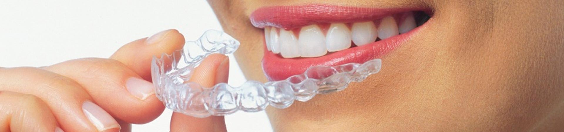 Usynlig tannregulering Invisalign